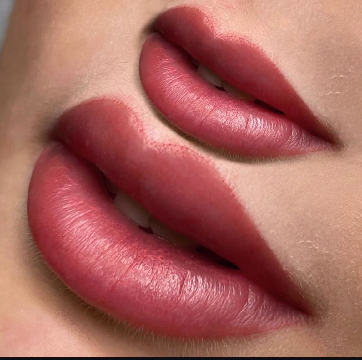 Dudak Renklendirme Bursa Nilüfer (6)