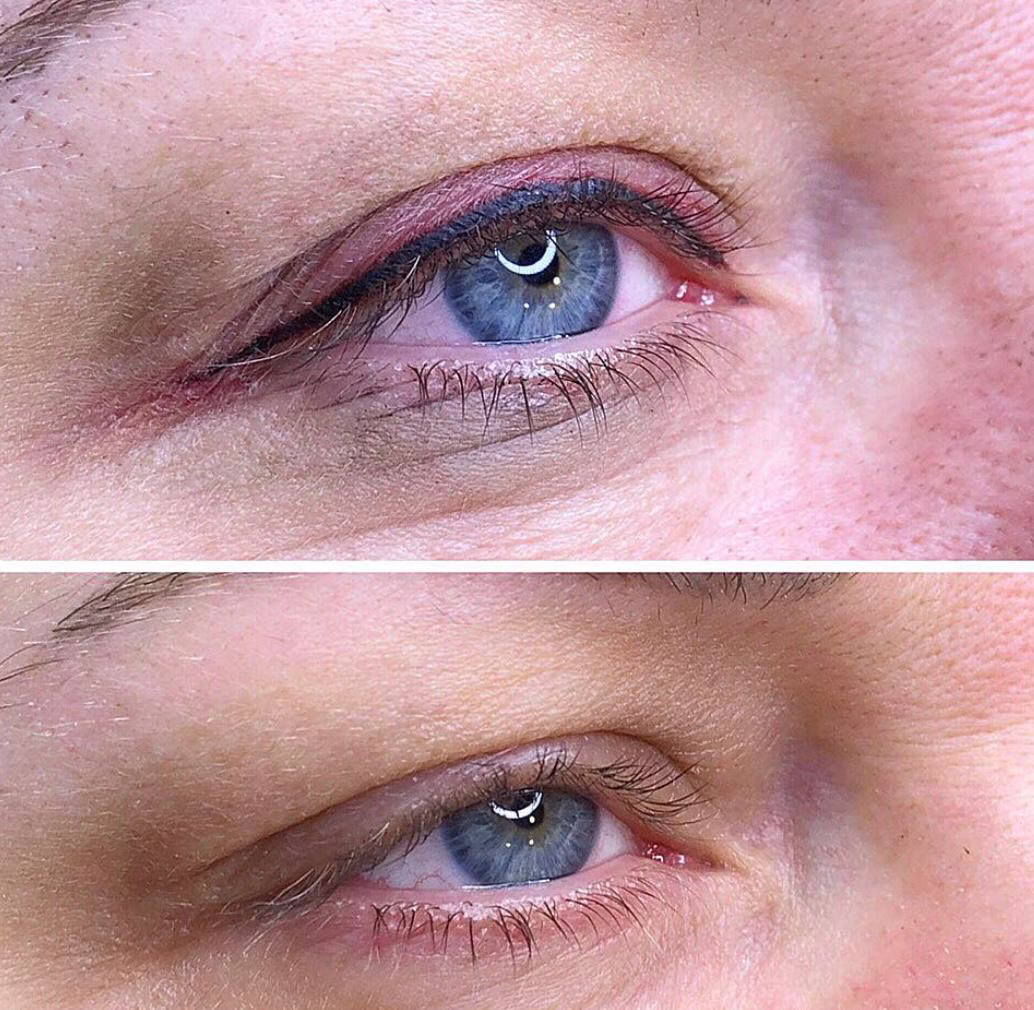 Kalıcı Eyeliner Bursa Nilüfer (9)